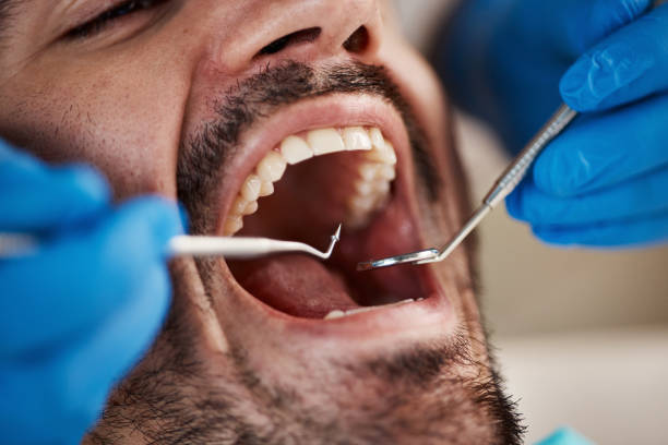 Best Root Canal Treatment  in Benicia, CA